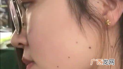 面带七星痣的征兆和寓意 女人脸上北斗七星痣好吗