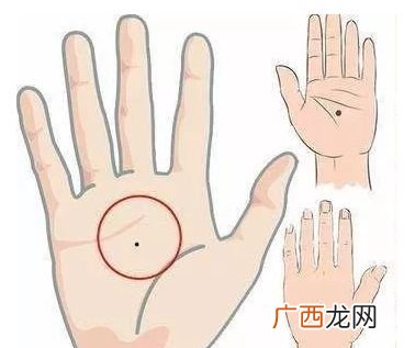 手掌痣主富贵 手掌有痣代表什么意思