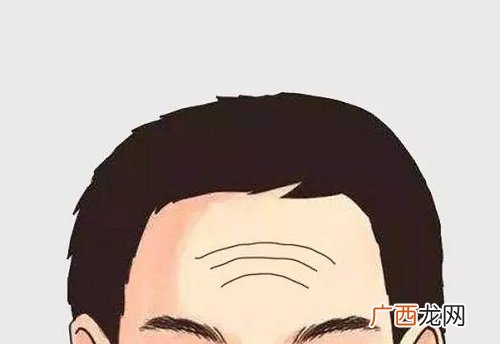 男人额头各种横纹命运吉凶详解 额头有横纹的男人面相