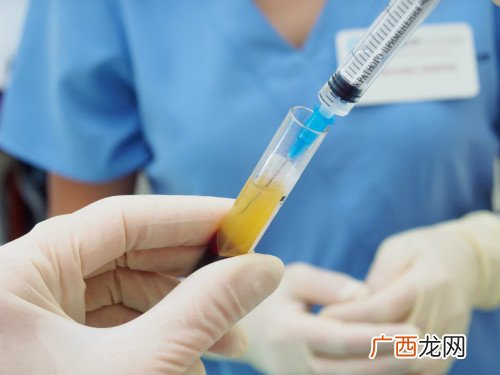 输血小板一般输多少,输血小板的注意事项有哪些？