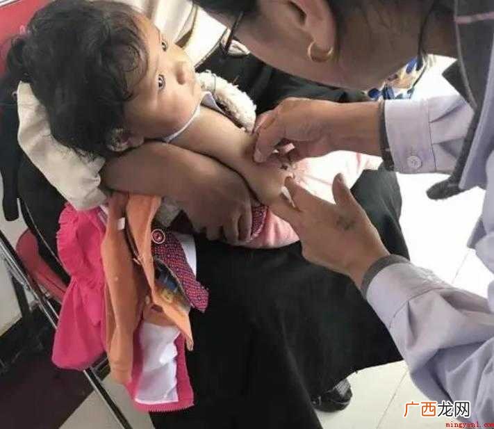 麻风疫苗是什么