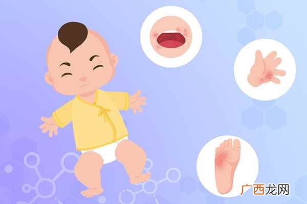 怎么预防春季传染病