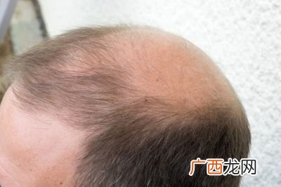 头发软化后多久才能洗头,为什么软化后三天才能洗头发？