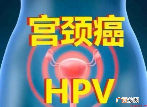 预防宫颈癌的疫苗年龄几岁最好