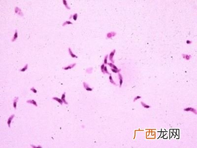 刚地弓形虫的性格改变,刚地弓形虫是什么科动物?