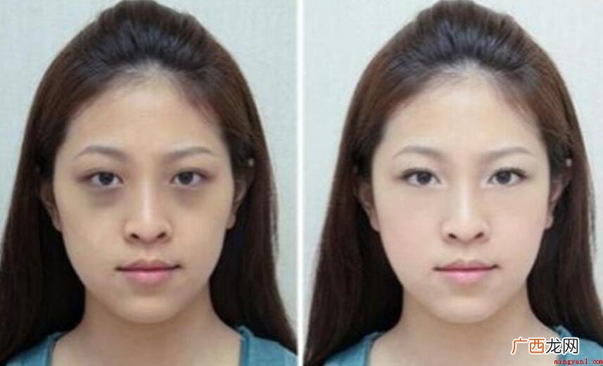 眼袋发黑是什么原因_健康频道 眼袋发黑是怎么回事
