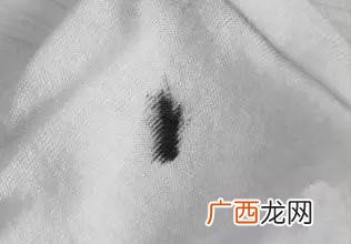 怎样去除顽固污渍,老污渍发黄怎么去除？