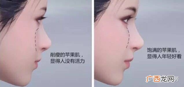 苹果肌是什么,男生苹果肌的好处和缺点？