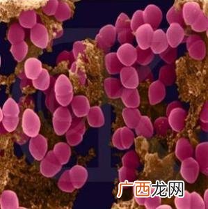球菌有哪些属,常见微生态菌群是什么意思？