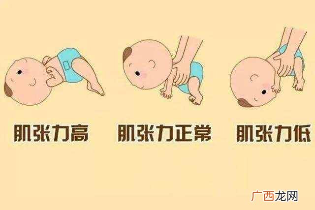 肌张力高几个月会消失