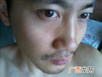 连毛胡子怎么办,用剪刀剪连毛胡子怎么样？