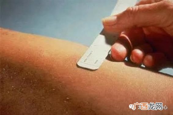 ppd实验是啥意思,appd实验是什么？