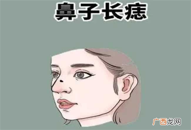 女性鼻子左边长痣意味着什么比较好 鼻子左侧有痣的女人好不好