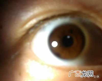 什么是重瞳.,重瞳里面的重念是什么？