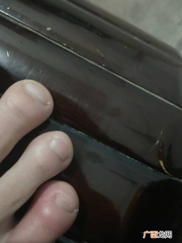 脚趾头肿了怎么消肿,小脚趾肿怎么消肿？
