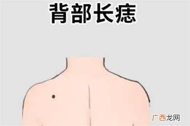男人背上有痣代表什么 男人背上长痣好不好