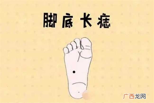 脚底长痣的特殊含义
