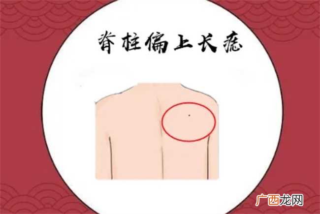 男人背上有痣代表什么