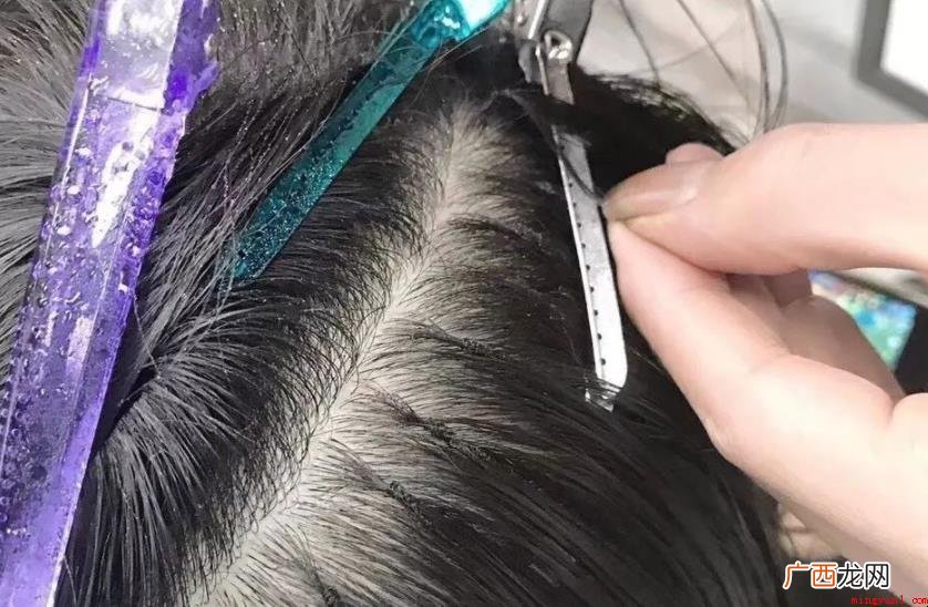 接发会导致掉发吗?_健康频道 接发会导致掉发吗