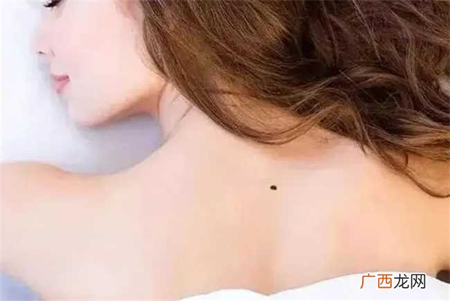 长在背上的痣代表着什么