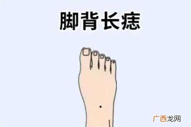 哪里长痣的女人大富大贵