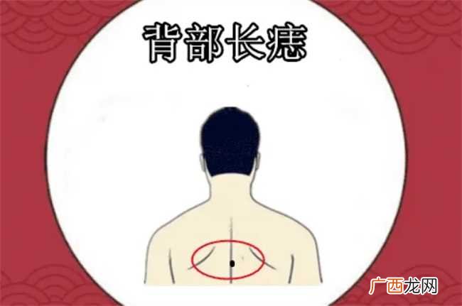 长在背部的痣有何寓意