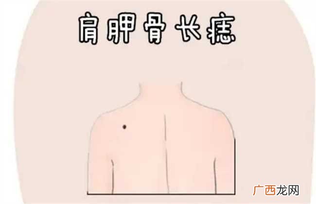 后背长痣有什么寓意