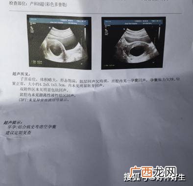 卵黄囊多久出现胎心胎芽,囊内可见卵黄囊是什么意思，是不是怀孕了呢？