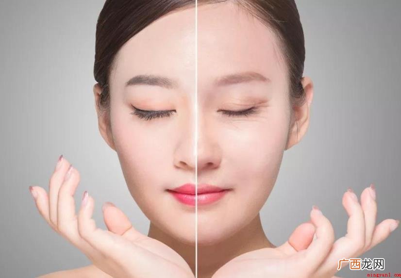 面部线雕术后注意事项有哪些