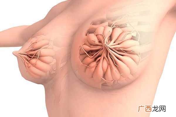 乳房癌症的早期信号