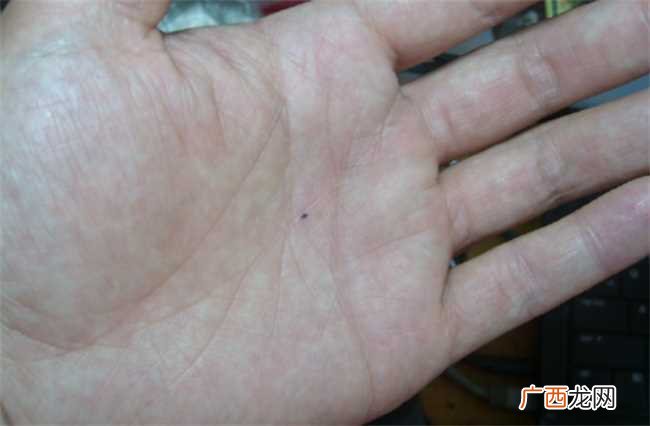 手心有痣代表什么