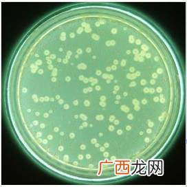 铜绿假单胞菌是什么病的致病菌,绿色杆菌是什么？