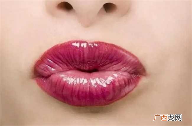 女人脸上哪些地方长痣最不好 女人脸上哪里长痣命不好
