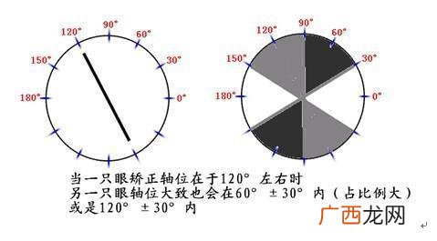 轴位多少为正常,六年级学生眼睛轴位多少？