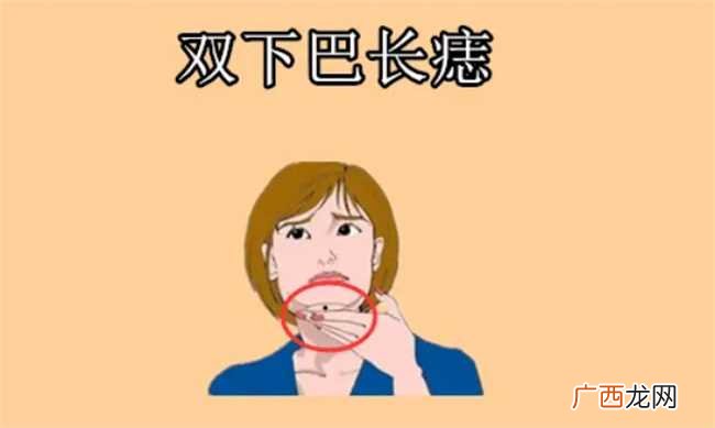 女人脸上长痣好不