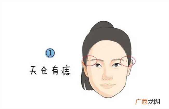脸上痣真的决定命运吗