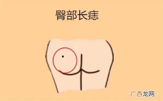 痣对人的命运有关系吗 痣到底和命有没有关系
