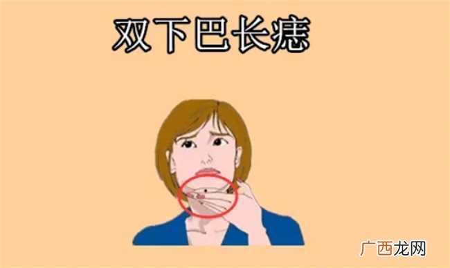 女人脸上哪些痣不能去掉 女人脸上哪些痣不能动