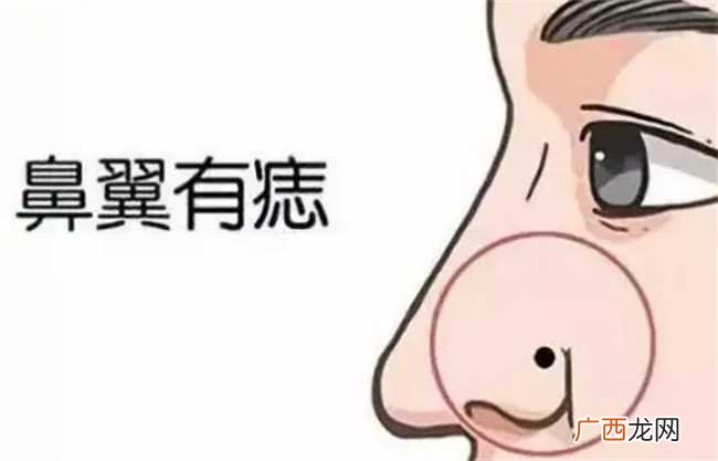 脸上长痣代表什么意思 脸上长痣有什么寓意
