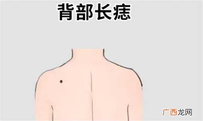 男人后背上有痣代表什么 后背有福痣解析男人