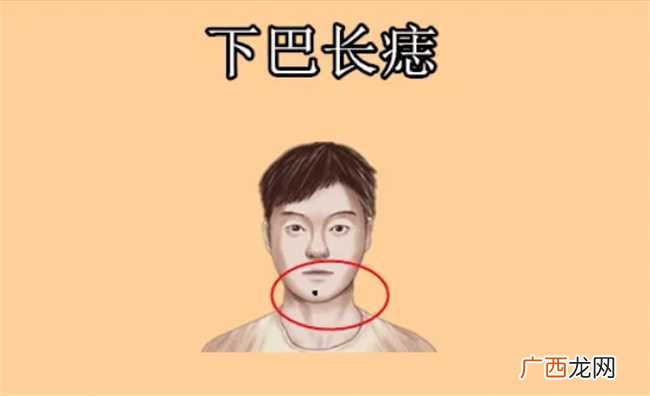 下巴长痣好不好