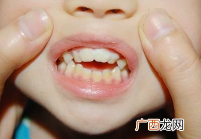 正常人的牙齿有多少,正常人有多少颗牙齿?