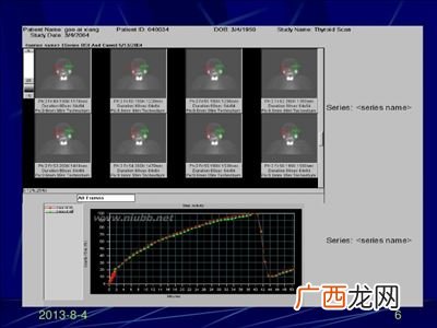 ect是什么意思,ect后缀的英语单词？
