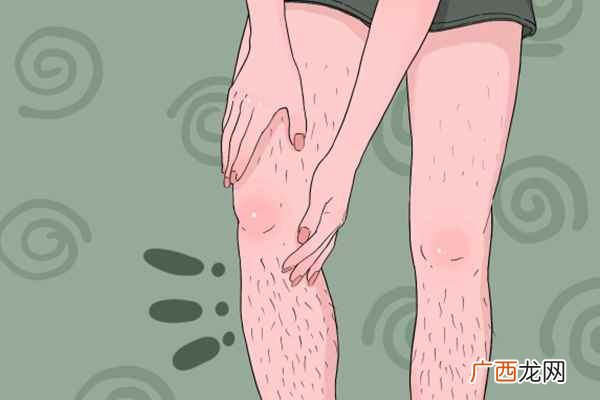 去腿毛的方法 怎样去腿毛