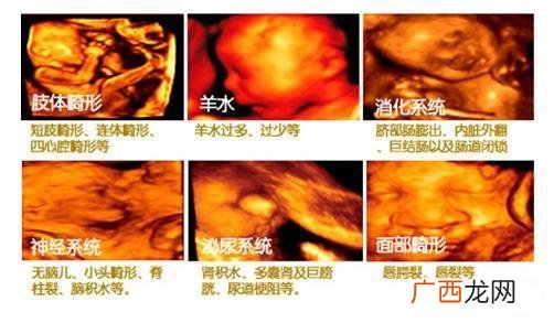 四维彩超排畸多少周,四维是6个月做吗？