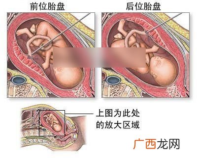 多少周做脐带血检查,脐带血检查要几个月才能做？