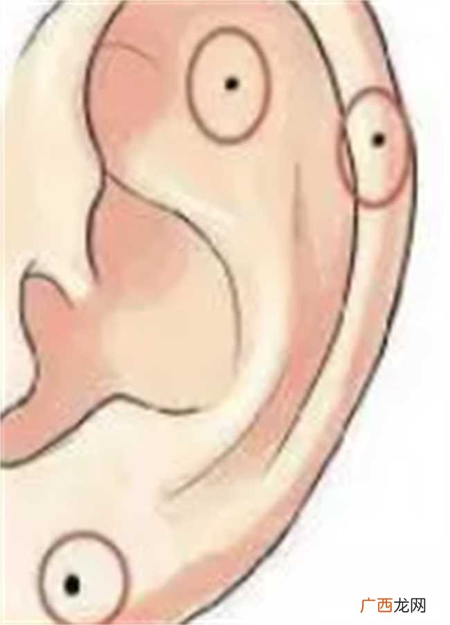 耳朵长痣解读人生运势 耳朵长痣有何人生运势