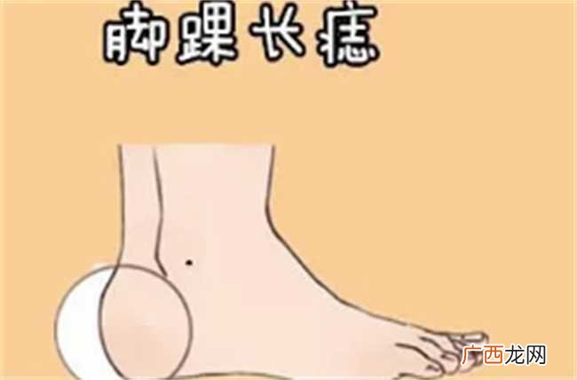 脚踝有痣的人性格和命运怎么样 脚踝有痣的人性格如何