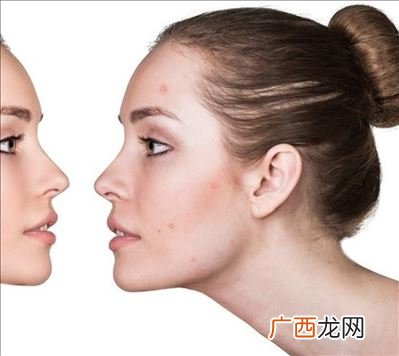 女生私密处长痘痘是怎么回事,女生下面长了像痘痘一样的东西怎么回事？