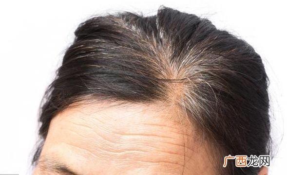 怎么生头发,如何让头发快速生长？